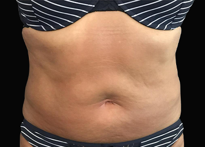 Resultados de moldeamiento Exilis