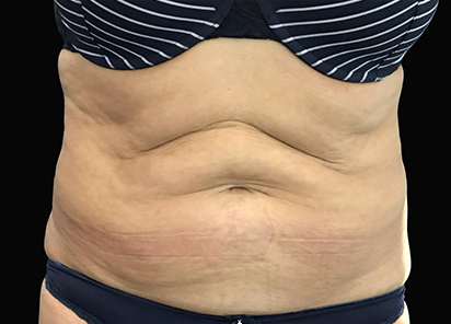 Resultados de moldeamiento Exilis