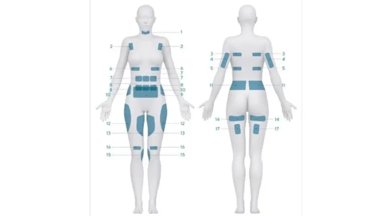 Cooltech: Moldeamiento Corporal con el poder del frío (Criolipólisis) El Cooltech es uno de los tratamientos de vanguardia en nuestra clínica Kintsugi. Se trata de una tecnología de criolipólisis médica diseñada para eliminar la grasa localizada de forma definitiva, sin necesidad de recurrir a cirugía y sin tiempo de recuperación. Está reconocido como el procedimiento No quirúrgico MAS efectivo para el moldeamiento corporal. Es un dispositivo seguro, con registro Invima, registro FDA y registro de comunidad Europea para manejo médico exclusivo.