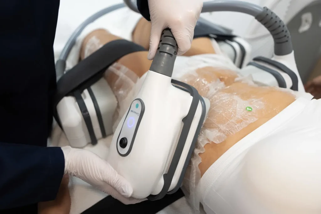 Cooltech Moldeamiento corporal Criolipólisis